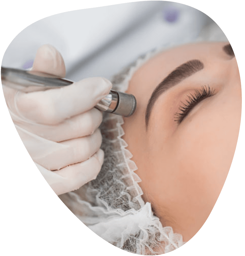 Microdermabrasion