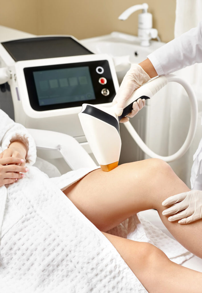 laser hair removal